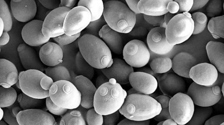 Saccharomyces cerevisiae_SEM