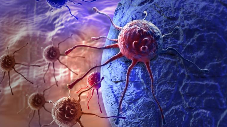Ein Tumor Ist Nicht Gleich Krebs