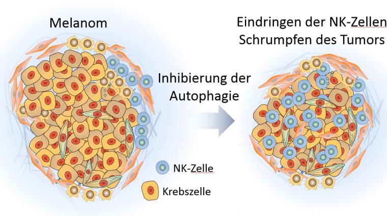 Melanom und NK-Zellen