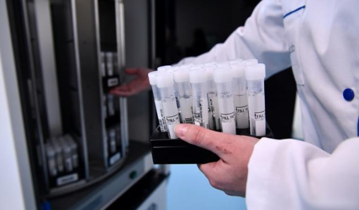 Des échantillons de salive dans le laboratoire d'analyse de l'endométriose Ziwig à Tercis-les-Bains, dans le département des Landes, le 25 mars 2024