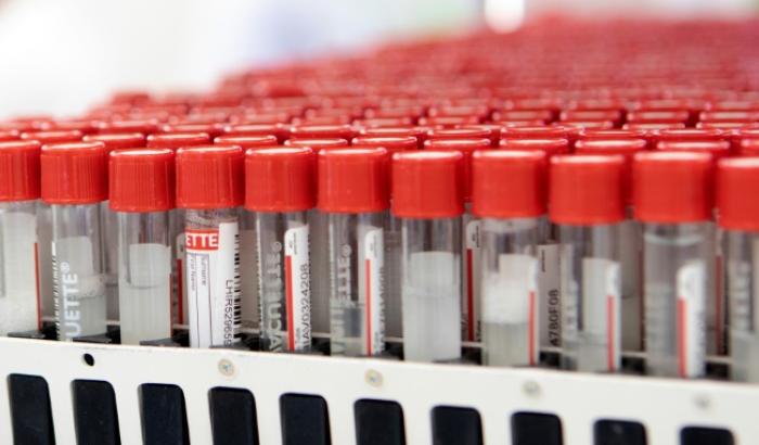 Krankmachende Viren in Patientenproben können künftig schneller identifiziert werden. Forscher des Robert-Koch-Instituts entwickelten ein neues Verfahren, mit dem Proben auf hunderte verschiedene Viren gleichzeitig untersucht werden können.