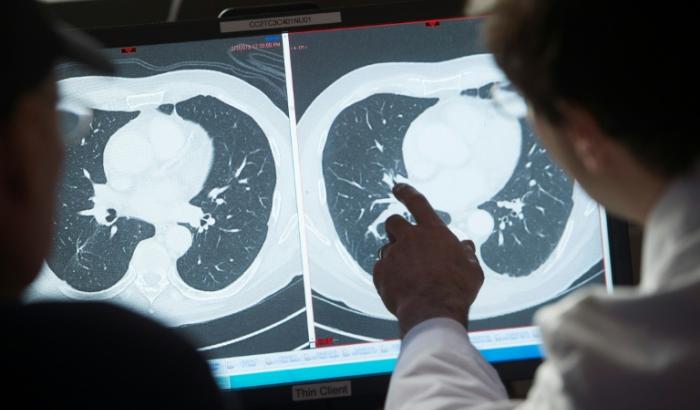 Nicht nur das kalendarische Alter, sondern auch die individuelle Alterung hat laut einer Studie Einfluss auf das Krebsrisiko. Eine schnellere biologische Alterung erhöht das Risiko zusätzlich, wie das Deutsche Krebsforschungszentrum mitteilte.