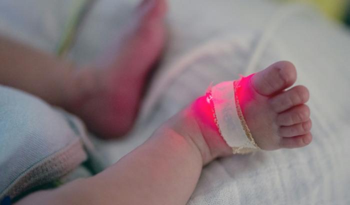 Des bébés semblent pouvoir échapper à de graves maladies grâce à une manipulation génétique lors de leur conception