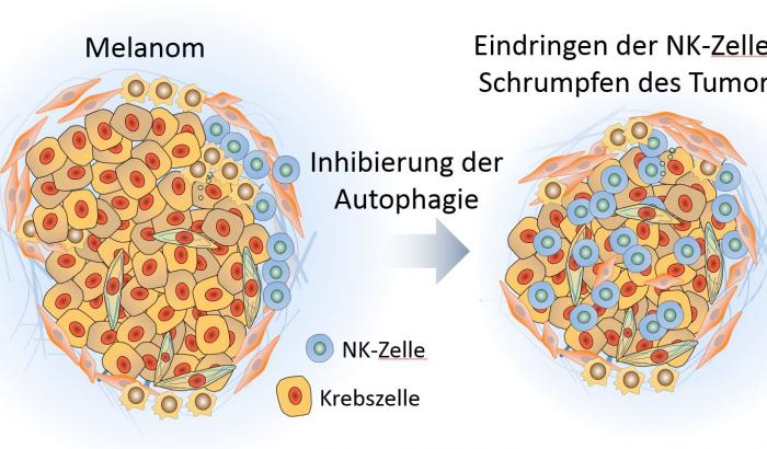 mélanome et cellules NK