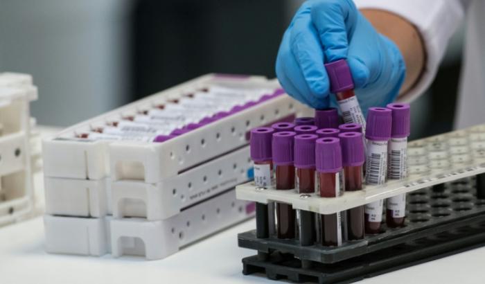 Cette technologie, également appelée de l'ADN tumoral circulant, consiste à suivre l'évolution d'un cancer par une simple prise de sang - et non par biopsie classique