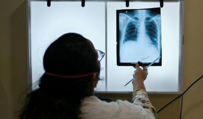 Derzeit in der Entwicklung befindliche neue Impfstoffe gegen Tuberkulose könnten nach Einschätzung der internationalen Impfallianz Gavi binnen weniger Jahre Millionen von Menschenleben retten.