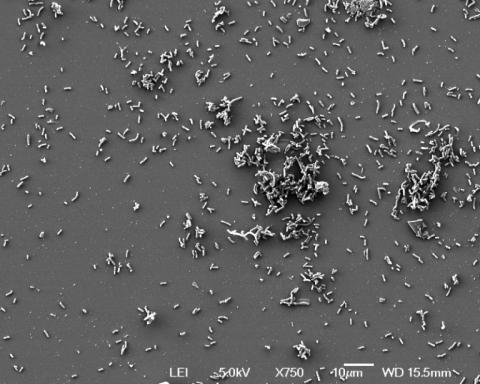 Des bactéries Yersinia pestis photographiées sur un cliché publié par l'Institut Pasteur, à Paris le 27 mai 2025