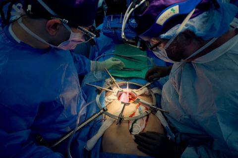 L'équipe de l'hôpital NYU Langone de New York lors de la transplantation du rein d'un porc génétiquement modifié sur un humain en état de mort cérébrale, le 14 juillet 2023