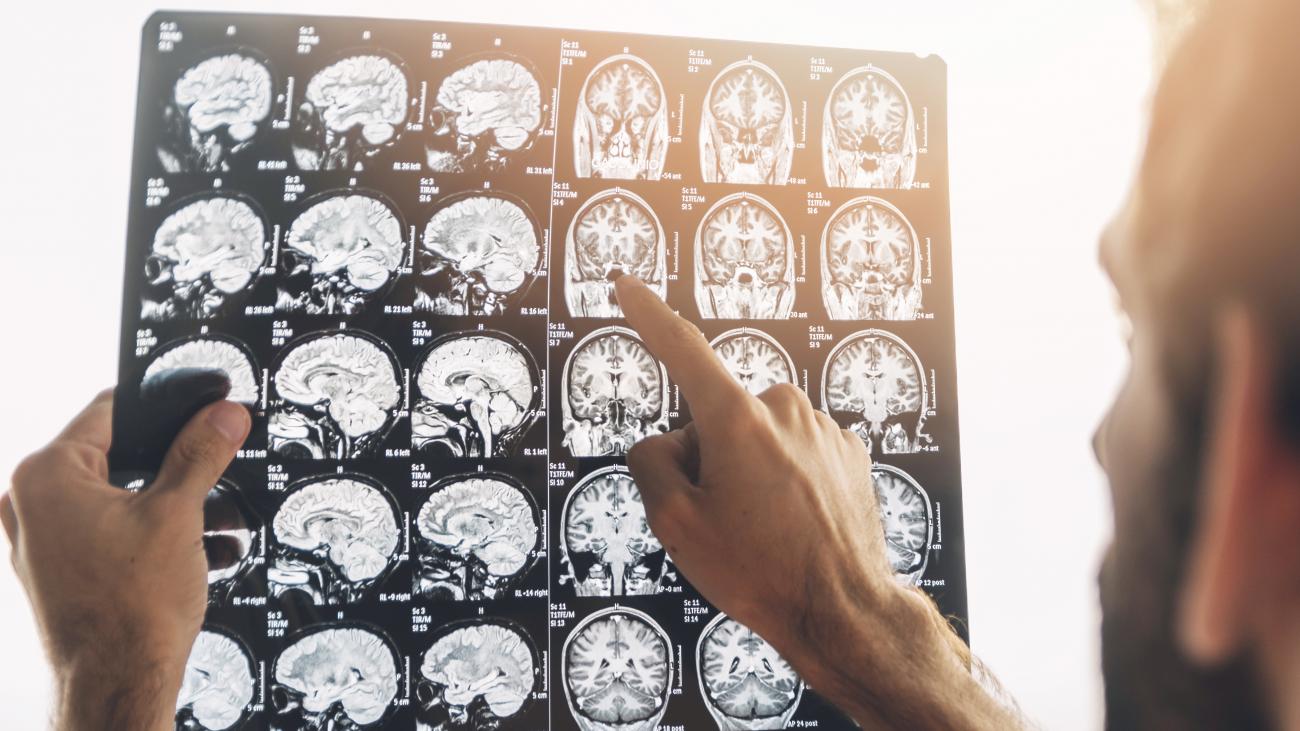 Vers un diagnostic précoce de la maladie d’Alzheimer à l'aide d'un jeu ...