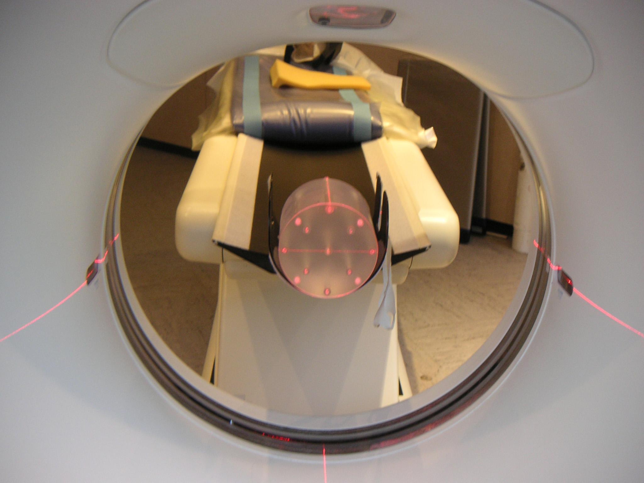 Worauf man beim Röntgen achten muss