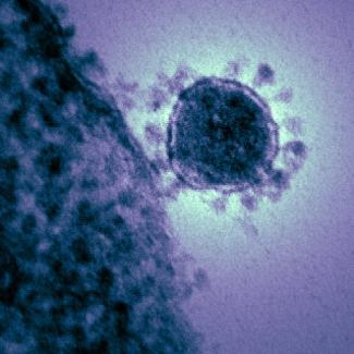 Coronavirus transmission electron microscopy