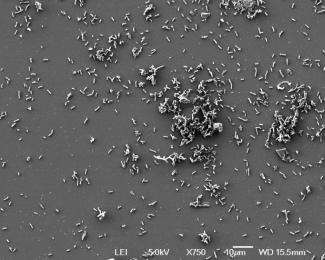 Des bactéries Yersinia pestis photographiées sur un cliché publié par l'Institut Pasteur, à Paris le 27 mai 2025