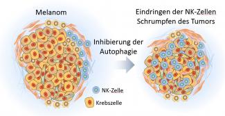 Melanom und NK-Zellen