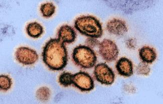 Image transmise le 27 février 2020 par les Instituts américains de la santé montrant le virus SARS-CoV-2 à l'origine du Cofid-19